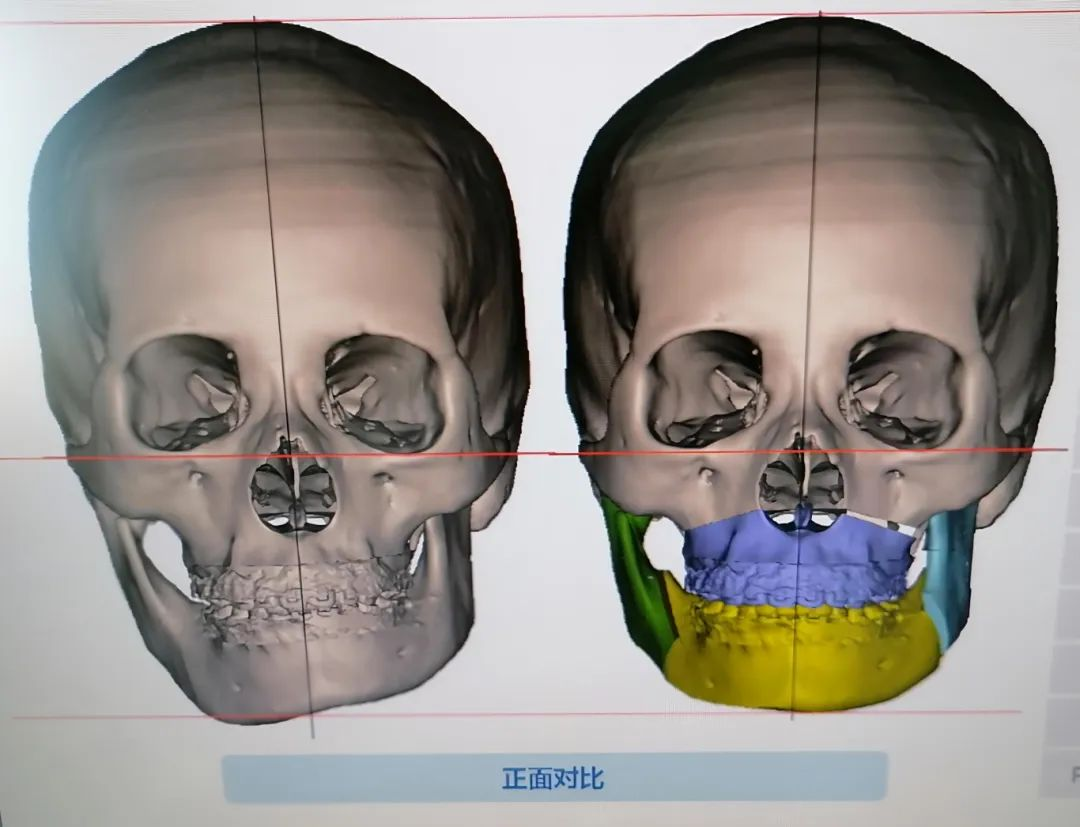 5dea12c9c2c5cf50661dda12b7733f54.png